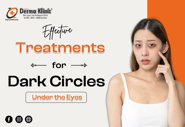 Best Skin Doctor in Lucknow, Best Dark Circle Treatment in Lucknow