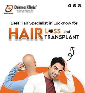  Best Hair Treatment in Lucknow, Best Hair Specialist in Lucknow 