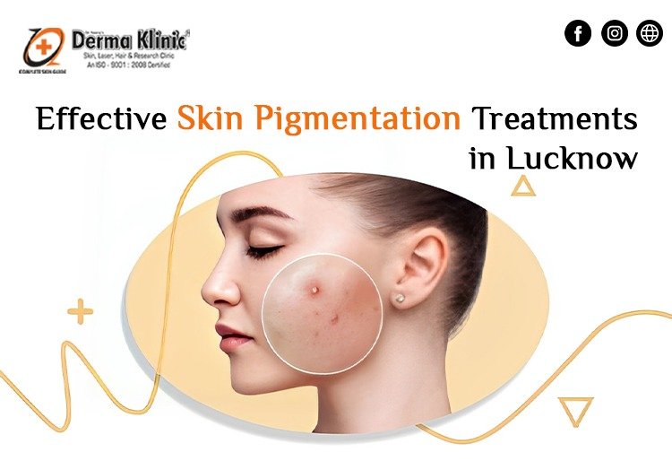 Best Skin Pigmentation Treatments in Lucknow,  Skin Doctor in Lucknow