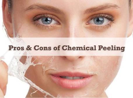 Plastic The pros and cons of chemical peels: Are they worth it? 